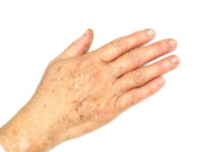 aging hands 400x294 300x221 1