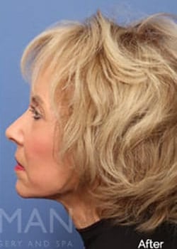 After Image: Profractional - other