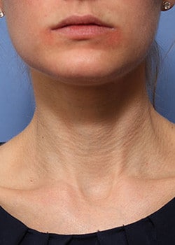 Before Image: Vivace - other