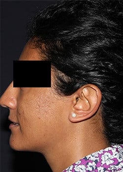 Before Image: Vivace - other