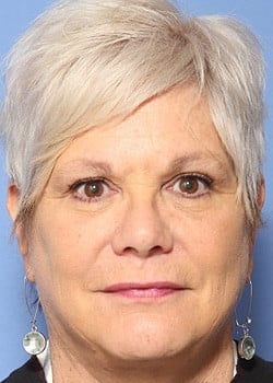 After Image: Facelift - front