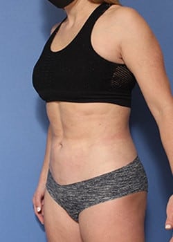 After Image: HD Vaser - left-front-oblique