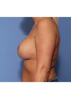 After Image